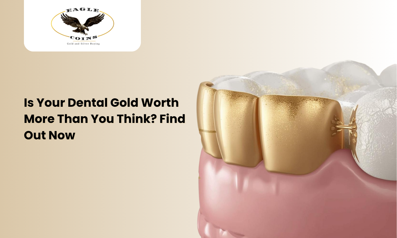 Is Your Dental Gold Worth More Than You Think Find Out Now