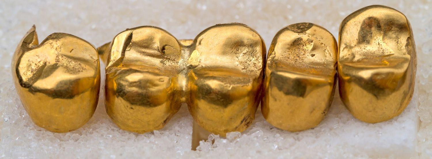 dentalgold